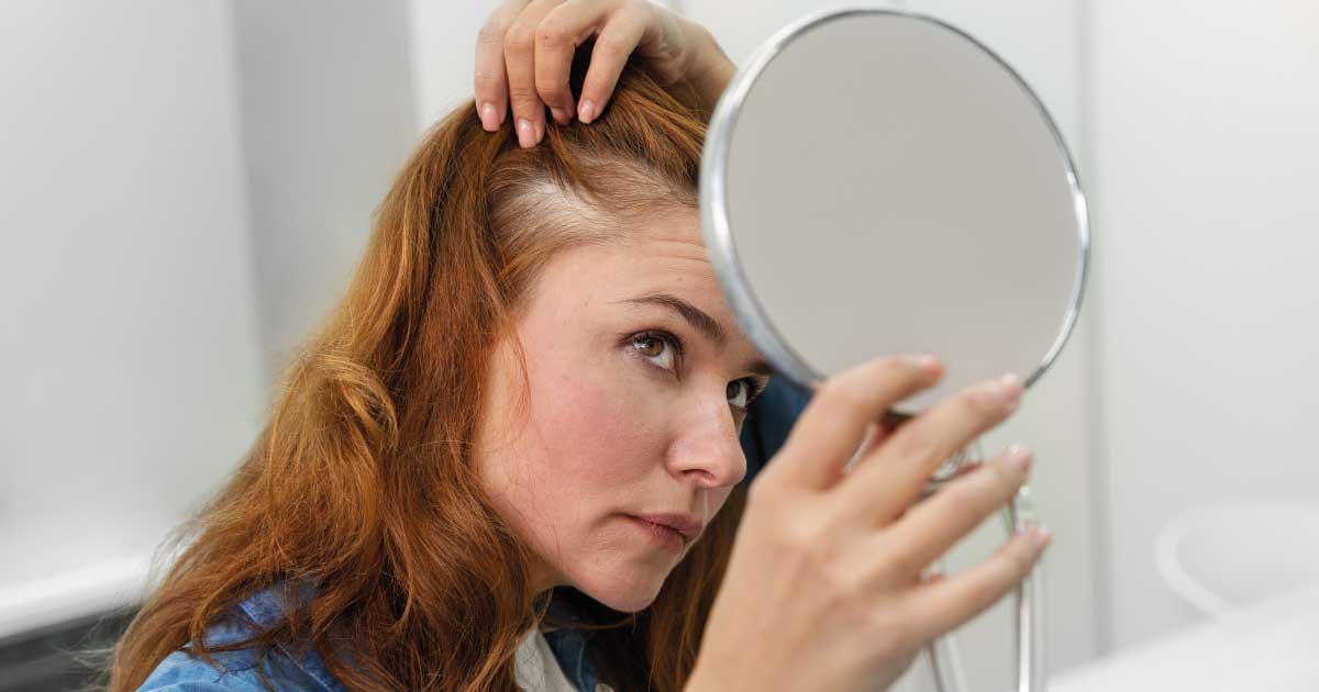 Calvície Masculina e Feminina: Diferenças e Tratamentos